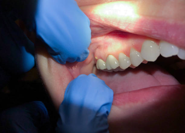 Best Walk-In Emergency Dentist in Mount Healthy, OH
